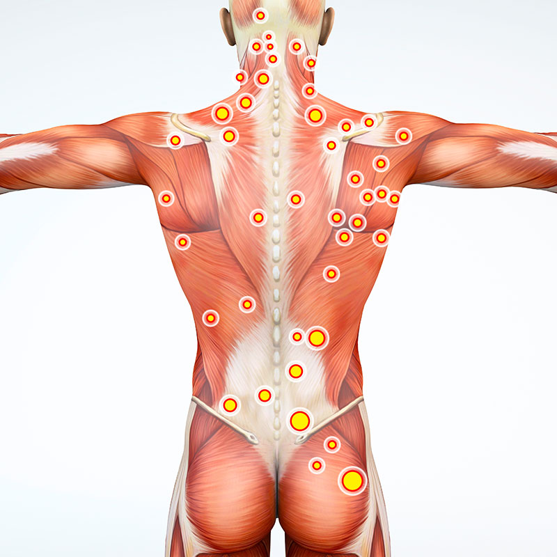 The Fascial System